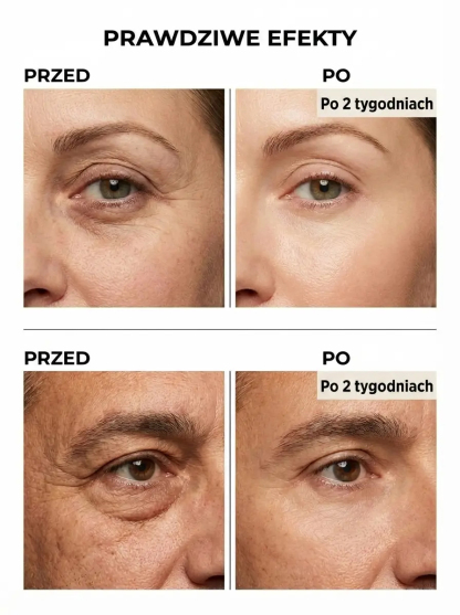 Balsam pod oczy z jadem pszczelim o działaniu ujędrniającym