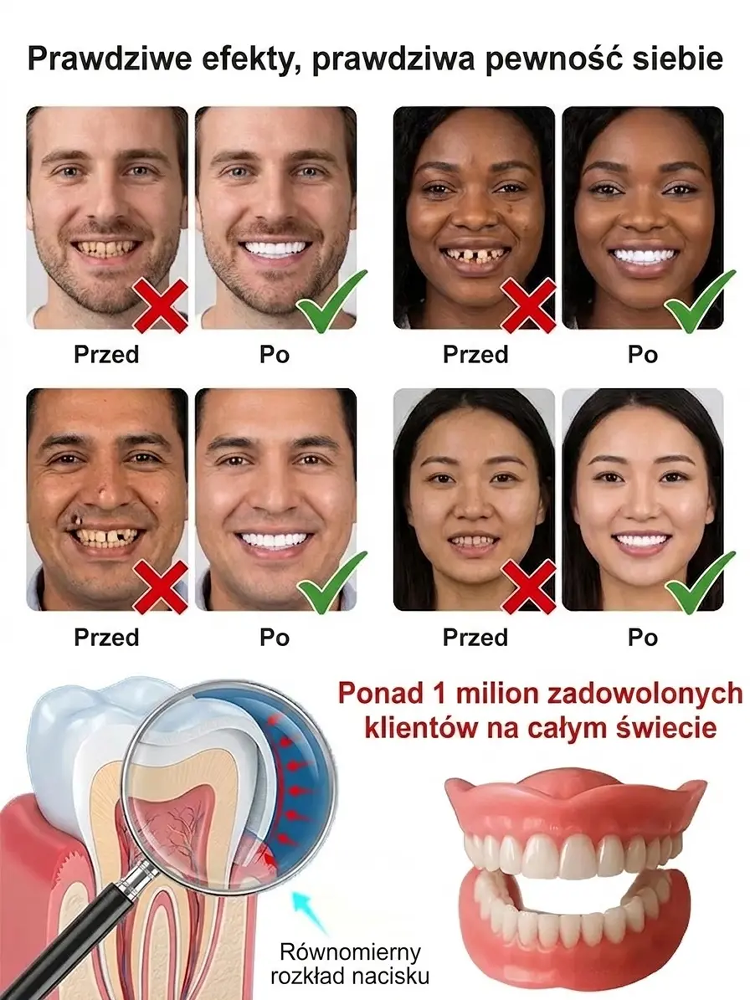 Mocno przylegające medyczne protezy całkowite🌟Naturalny Uśmiech & Ochrona Dziąseł | Do Jedzenia i Spania