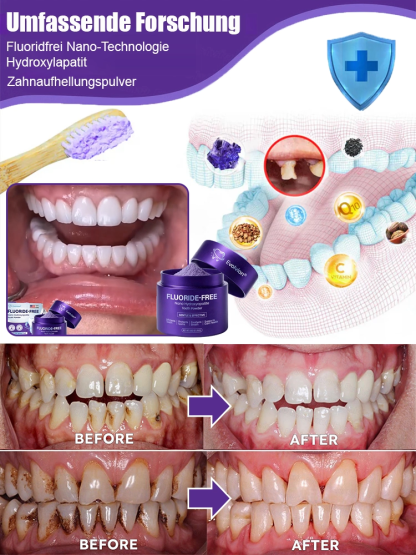 ✅Zahnverfärbungen lösen, Karies vorbeugen, Zahnfleisch reparieren - 50% Rabatt