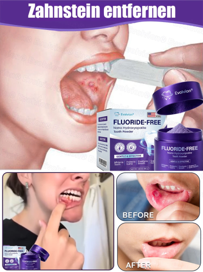 ✅Zahnverfärbungen lösen, Karies vorbeugen, Zahnfleisch reparieren - 50% Rabatt