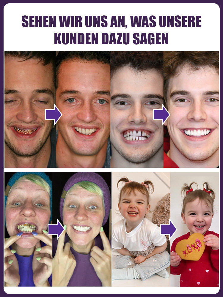 ✅Zahnverfärbungen lösen, Karies vorbeugen, Zahnfleisch reparieren - 50% Rabatt