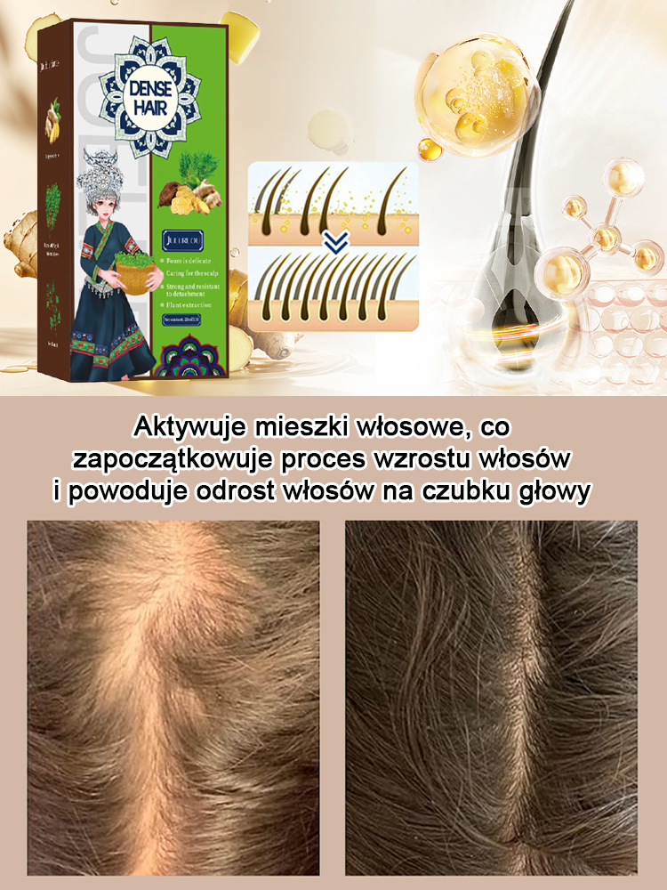 Gorąca sprzedaż Szampon przeciw wypadaniu włosów z ekstraktem z imbiru