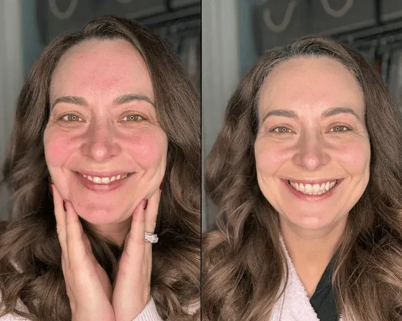 Foundation before and after result 1