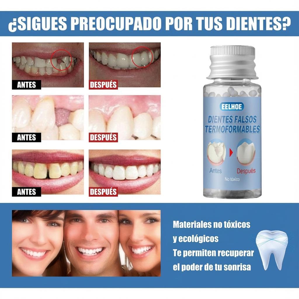 Gel Dental Moldeable EELHOE: Relleno Temporal para Dientes Rotos, Caries y Espacios | Kit de Reparación con Película Adhesiva y Láminas Dentales | Solución Reutilizable para Sonrisa Natural, Prótesis Moldeables