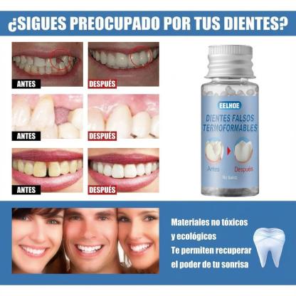 Gel Dental Moldeable EELHOE: Relleno Temporal para Dientes Rotos, Caries y Espacios | Kit de Reparación con Película Adhesiva y Láminas Dentales | Solución Reutilizable para Sonrisa Natural, Prótesis Moldeables