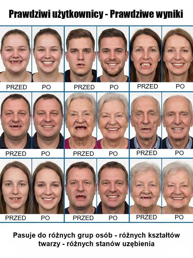 Nakładka ortodontyczna z pełnym dopasowaniem do twarzy✅Odpowiednie dla różnych kształtów twarzy, grup wiekowych oraz rozmaitych stanów uzębienia, takich jak krzywe lub brakujące zęby