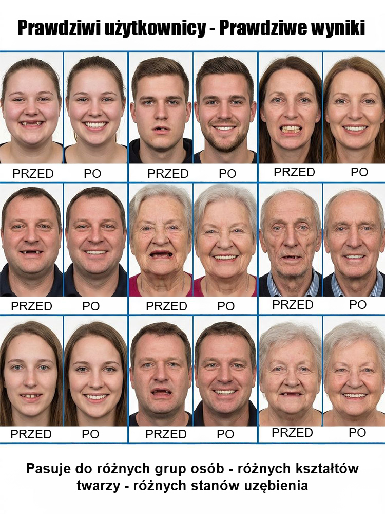 Nakładka ortodontyczna z pełnym dopasowaniem do twarzy✅Odpowiednie dla różnych kształtów twarzy, grup wiekowych oraz rozmaitych stanów uzębienia, takich jak krzywe lub brakujące zęby