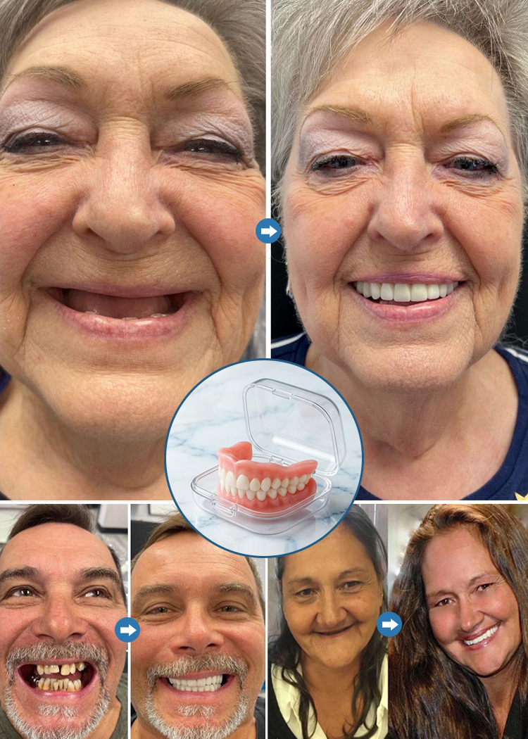 Przenośne pudełko do przechowywania protez zębowych pełnych📌Nie wymaga skomplikowanych czynności, jest łatwy w noszeniu i wygodniejszy