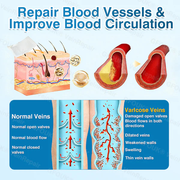US✅🌱 VeinRepair Microneedle Patch Roll ⚡ Instant Relief, Long-Term Results