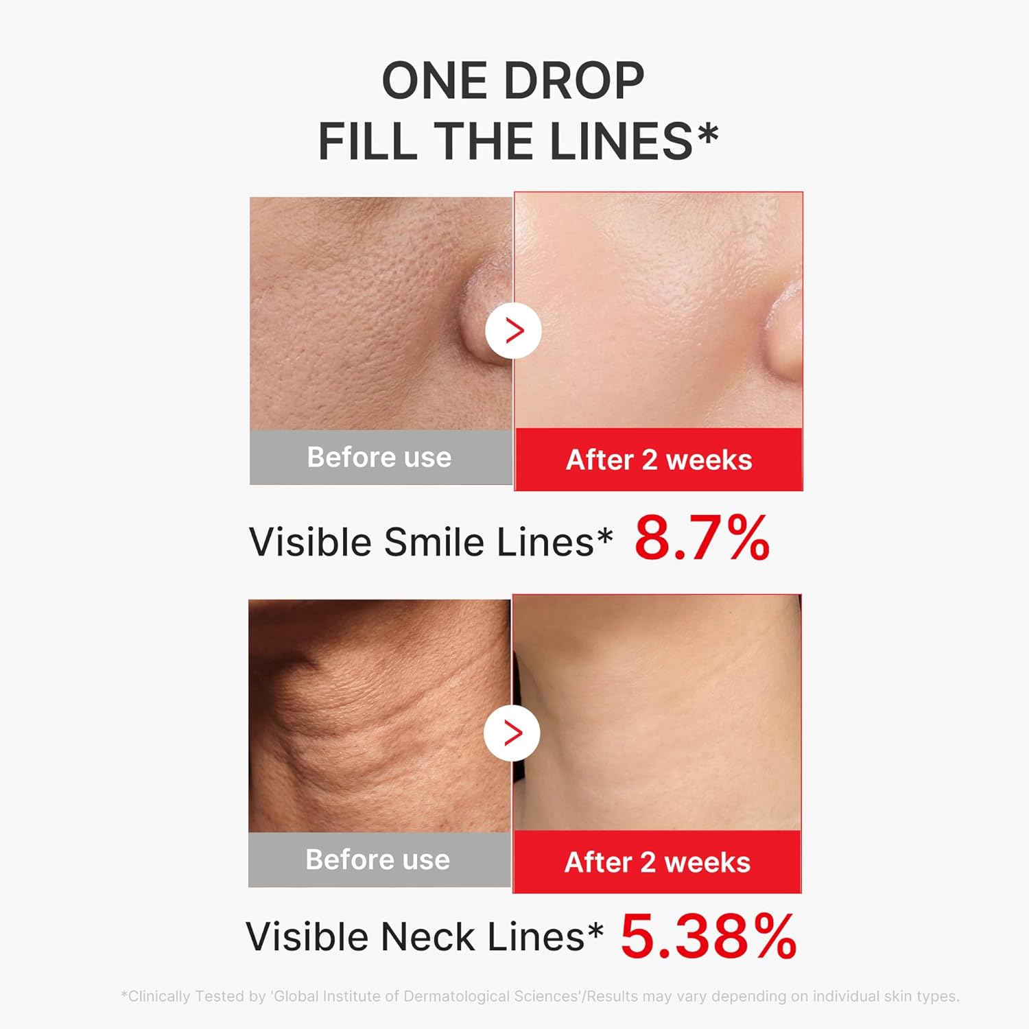 🔥LAST DAY DISCOUNT🔥Korean NAD+ EGF Firming Serum