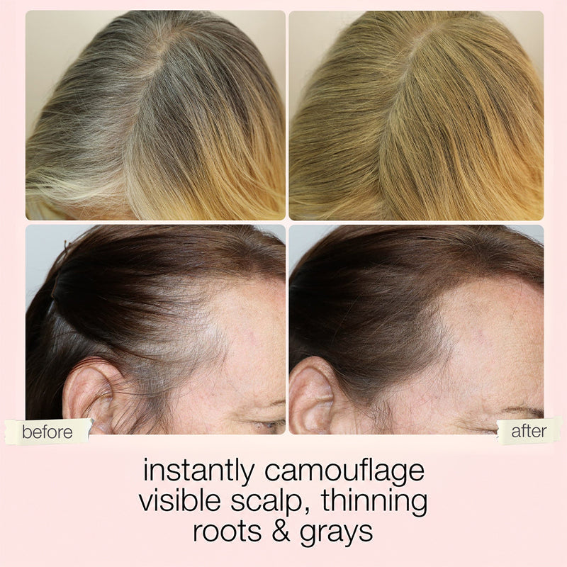 🎇Last Day Discount – One Touch To Hide Greys, Sparse Hair & Visible Scalp