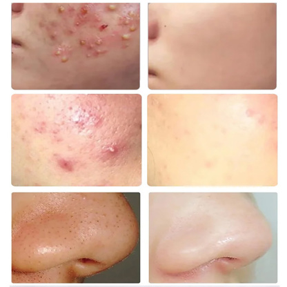 Hochpräzise Zellenklammern mit hoher Härte