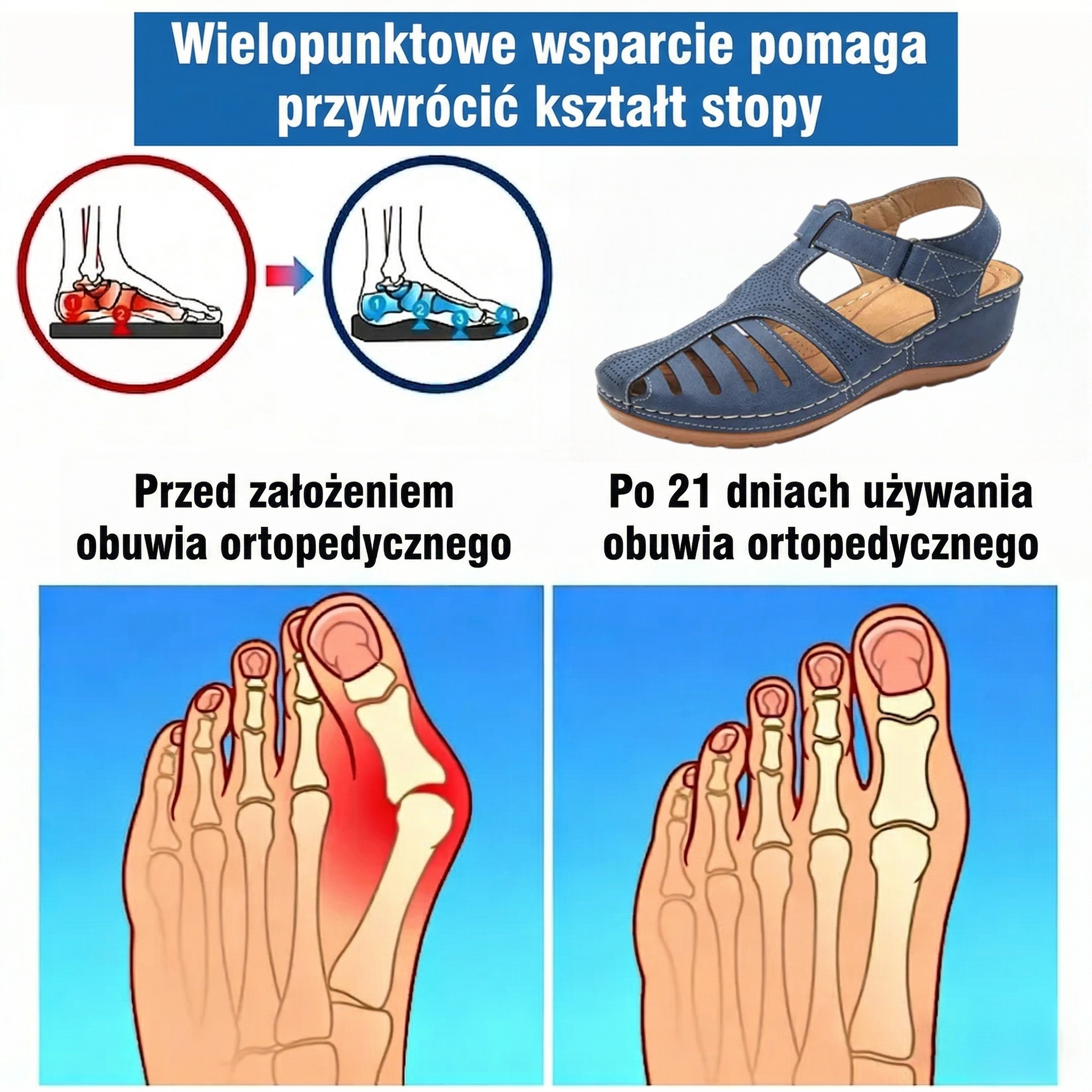 ⏰Ograniczona czasowo zniżka 50%🔥Letnie sandały ortopedyczne✅Wsparcie łuku stopy✅Wygodne i bezbolesne chodzenie✅Ergonomiczna konstrukcja