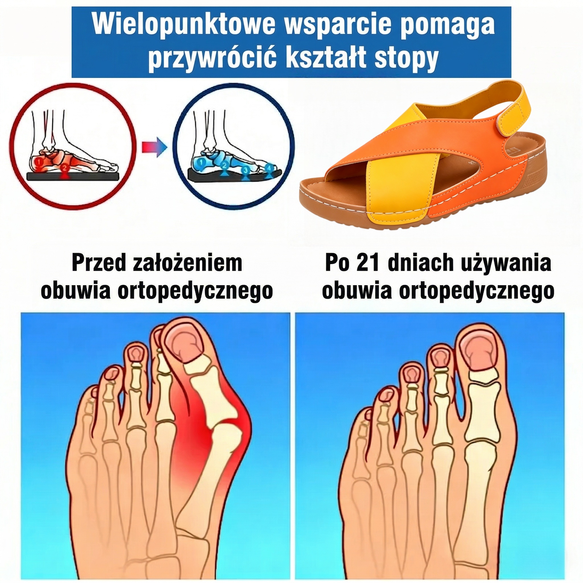 🎉50% zniżki dzisiaj - Nie przegap! ⏰✅Wsparcie łuku stopy✅Wygodne i bezbolesne chodzenie✅Ergonomiczna konstrukcja