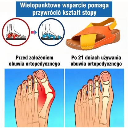 🎉50% zniżki dzisiaj - Nie przegap! ⏰✅Wsparcie łuku stopy✅Wygodne i bezbolesne chodzenie✅Ergonomiczna konstrukcja