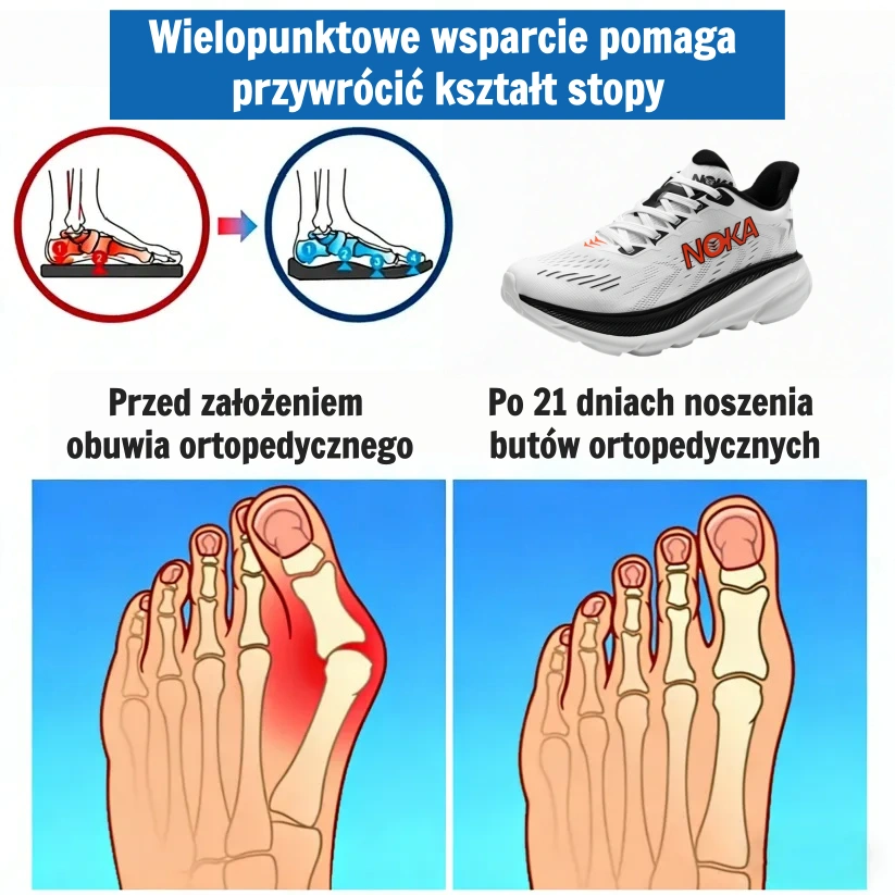 【⏰Oferta ograniczona czasowo: 70% zniżki – nie przegap!】👞Ergonomiczne buty ortopedyczne – ✅️Korygują postawę podczas chodzenia i łagodzą ból stóp – Nowa, ulepszona wersja, wodoodporna i antypoślizgowa🔥