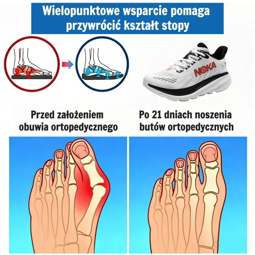 【⏰Oferta ograniczona czasowo: 70% zniżki – nie przegap!】👞Ergonomiczne buty ortopedyczne – ✅️Korygują postawę podczas chodzenia i łagodzą ból stóp – Nowa, ulepszona wersja, wodoodporna i antypoślizgowa🔥