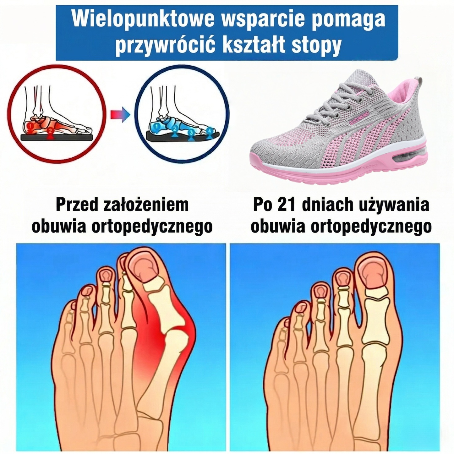 ⏰50% zniżki przez ograniczony czas: nie przegap! 🔥Ergonomicznie zaprojektowane buty ortopedyczne ✅Wsparcie łuku stopy ✅Wygodne i bezbolesne chodzenie