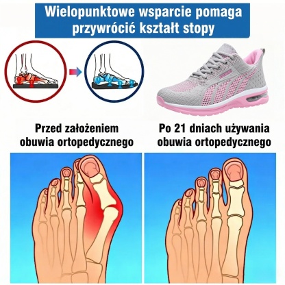 ⏰50% zniżki przez ograniczony czas: nie przegap! 🔥Ergonomicznie zaprojektowane buty ortopedyczne ✅Wsparcie łuku stopy ✅Wygodne i bezbolesne chodzenie