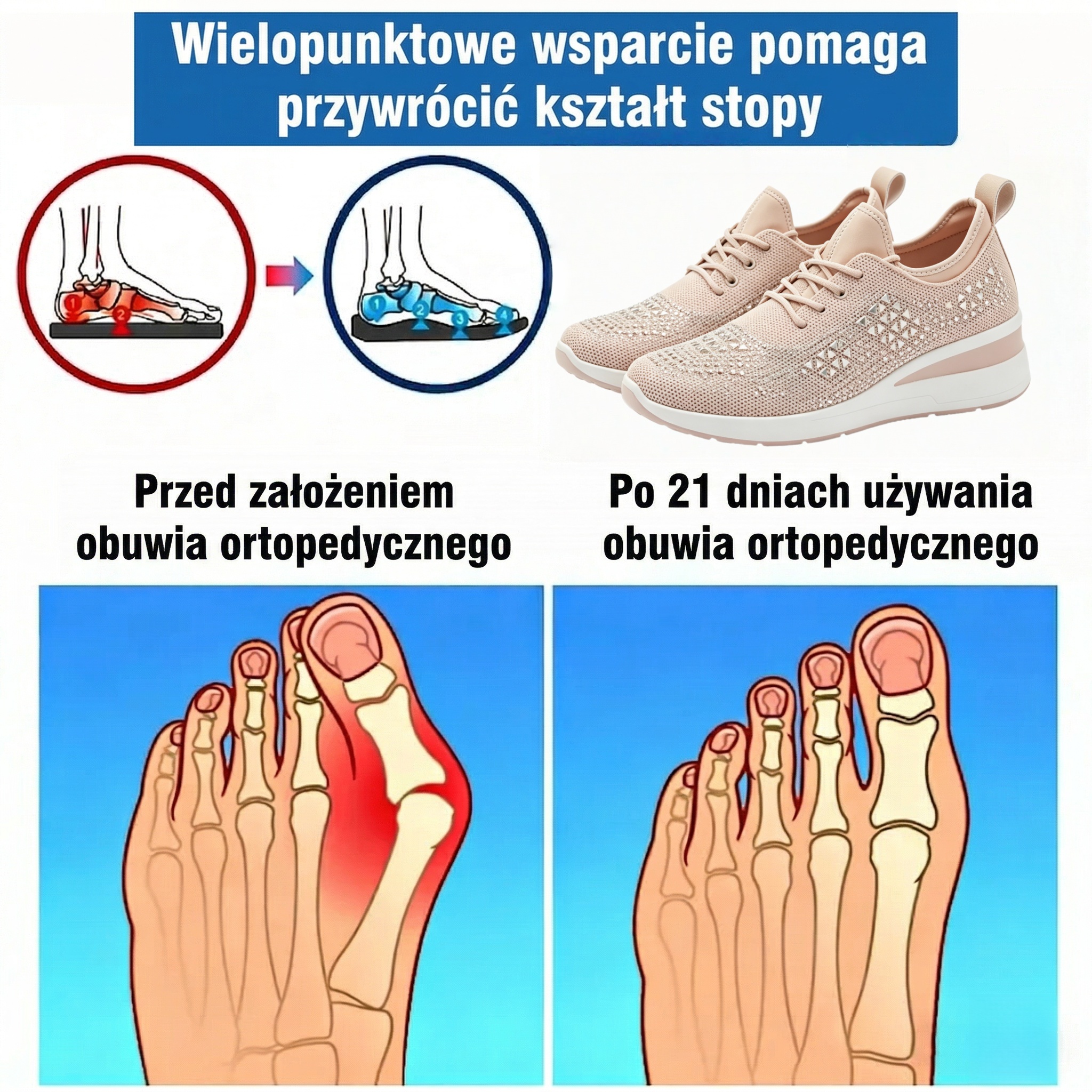 ⏰Oferta w połowie ceny 🔥Ergonomicznie zaprojektowane buty ortopedyczne ✅Wsparcie łuku stopy ✅Wygodne i bezbolesne chodzenie