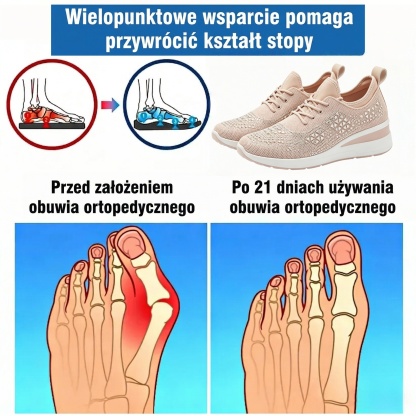 ⏰Oferta w połowie ceny 🔥Ergonomicznie zaprojektowane buty ortopedyczne ✅Wsparcie łuku stopy ✅Wygodne i bezbolesne chodzenie