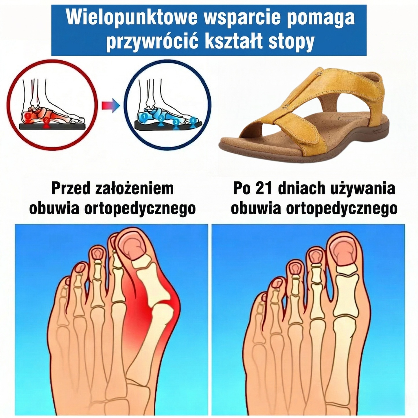 ⏰Ograniczona czasowo promocja z obniżką o połowę🔥Letnie sandały ortopedyczne ✅Wsparcie łuku stopy ✅Wygodne i bezbolesne chodzenie ✅Ergonomiczna konstrukcja