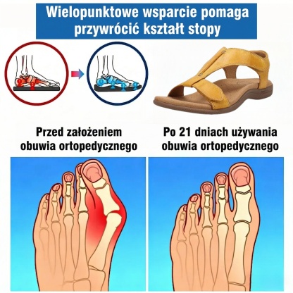 ⏰Ograniczona czasowo promocja z obniżką o połowę🔥Letnie sandały ortopedyczne ✅Wsparcie łuku stopy ✅Wygodne i bezbolesne chodzenie ✅Ergonomiczna konstrukcja