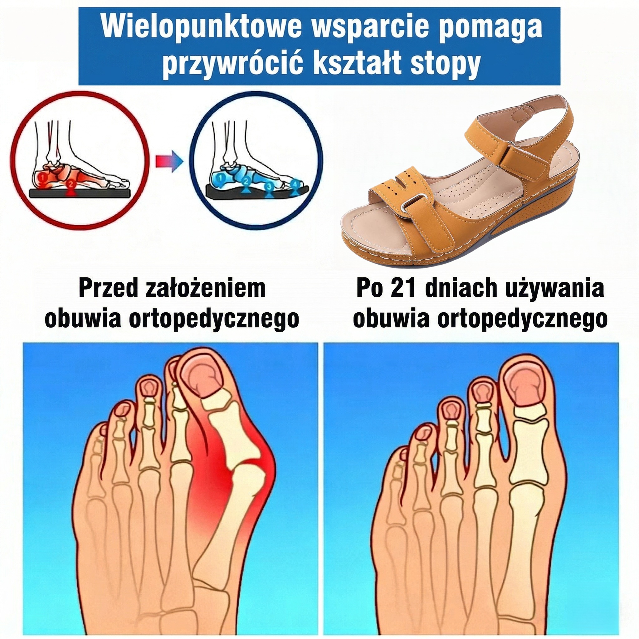 ⏰Ograniczona czasowo promocja z obniżką o połowę🔥Letnie sandały ortopedyczne ✅Wsparcie łuku stopy ✅Wygodne i bezbolesne chodzenie ✅Ergonomiczna konstrukcja