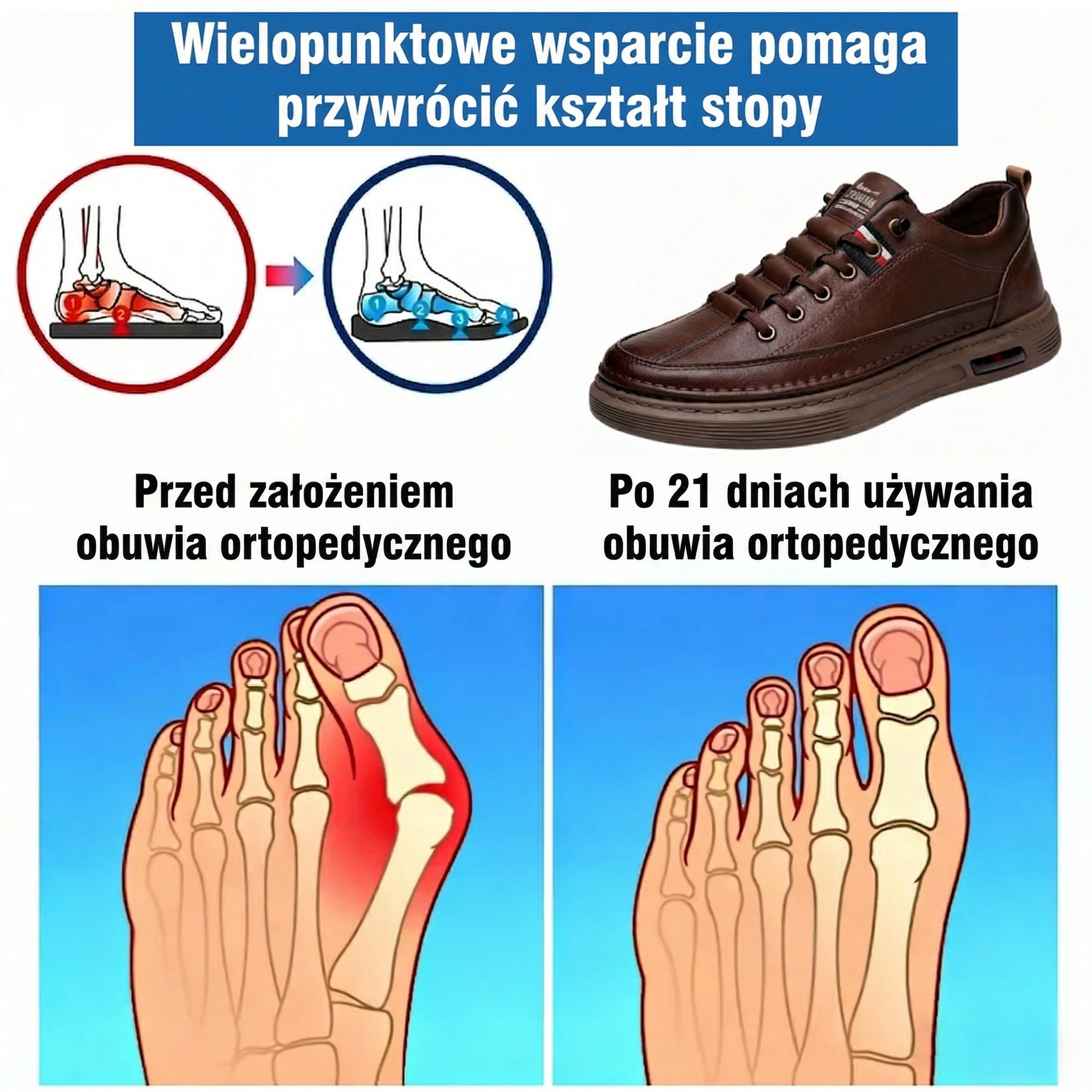 🎁Specjalna oferta rocznicowa – nie przegap!🎁Ortopedyczne buty skórzane premium👞Amortyzacja i redukcja nacisku ✅Stabilność i antypoślizgowość ✅Całodniowy komfort