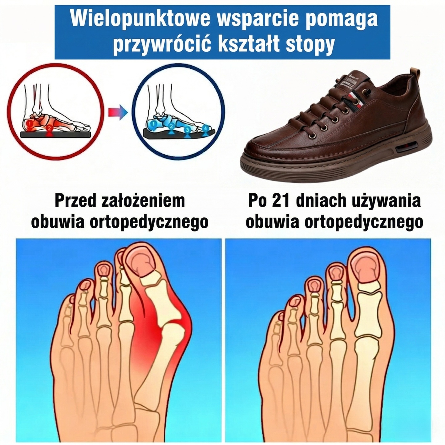 🎁Specjalna oferta rocznicowa – nie przegap!🎁Ortopedyczne buty skórzane premium👞Amortyzacja i redukcja nacisku ✅Stabilność i antypoślizgowość ✅Całodniowy komfort