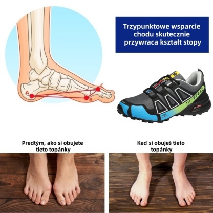 🔥70% zniżki dzisiaj - nie przegap ⏰ Ergonomiczne buty ortopedyczne na ból pleców, stawów i stóp - unisex