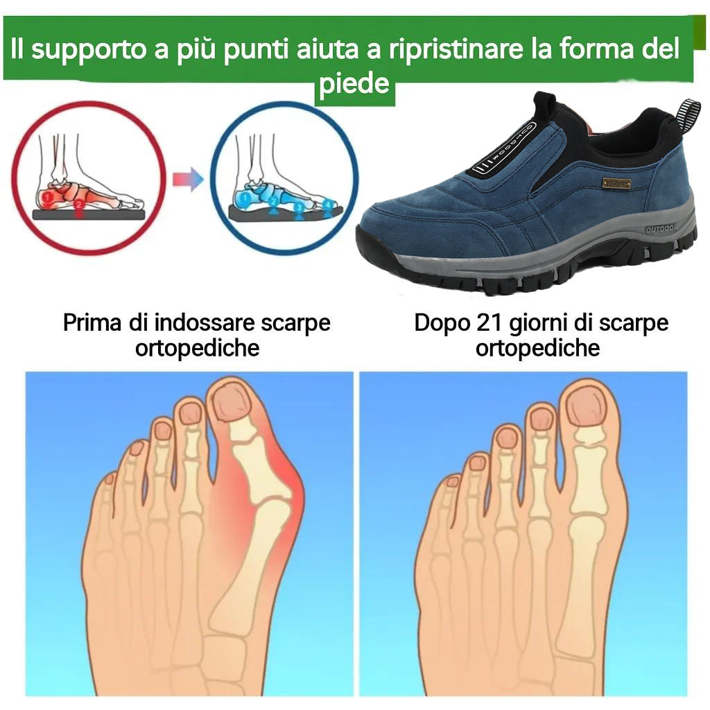 ✅Pantofi din piele întoarsă de înaltă calitate🦶Ameliorează durerile de picioare și fasciita - Impermeabili și antiderapanți🔴Pantofi ortopedici