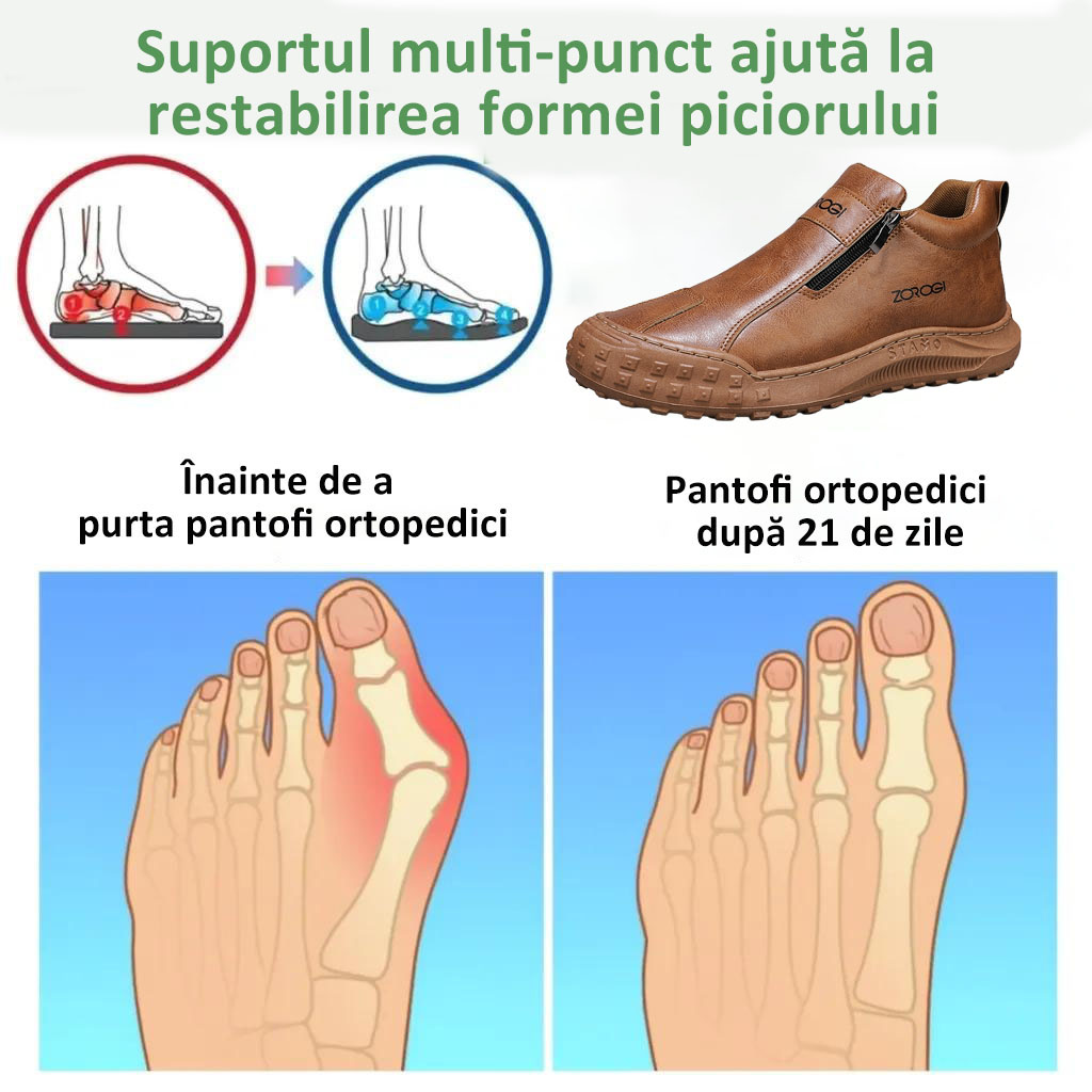 ⭕️Pantofi ortopedici din piele de vacă lucrați manual👞Branțuri ortopedice bazate pe inteligență artificială✅Ușor de încălțat și de îndepărtat, impermeabili și confortabili