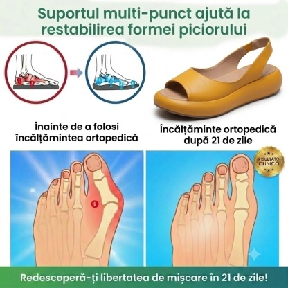 ⏰Ultima zi, reducere 60%! Nu ratați - Sandale ortopedice cu design ergonomic ✅️Amortizare șocuri ✅️Încălțăminte ortopedică sănătoasă, concepută special pentru femeile europene.