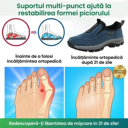 🎁Ultima zi pentru a te bucura de o reducere de 40%! Nu rata această oportunitate rară! ⏰Ameliorează durerile de picioare și fasciita cu pantofi ortopedici impermeabili și antiderapanți.