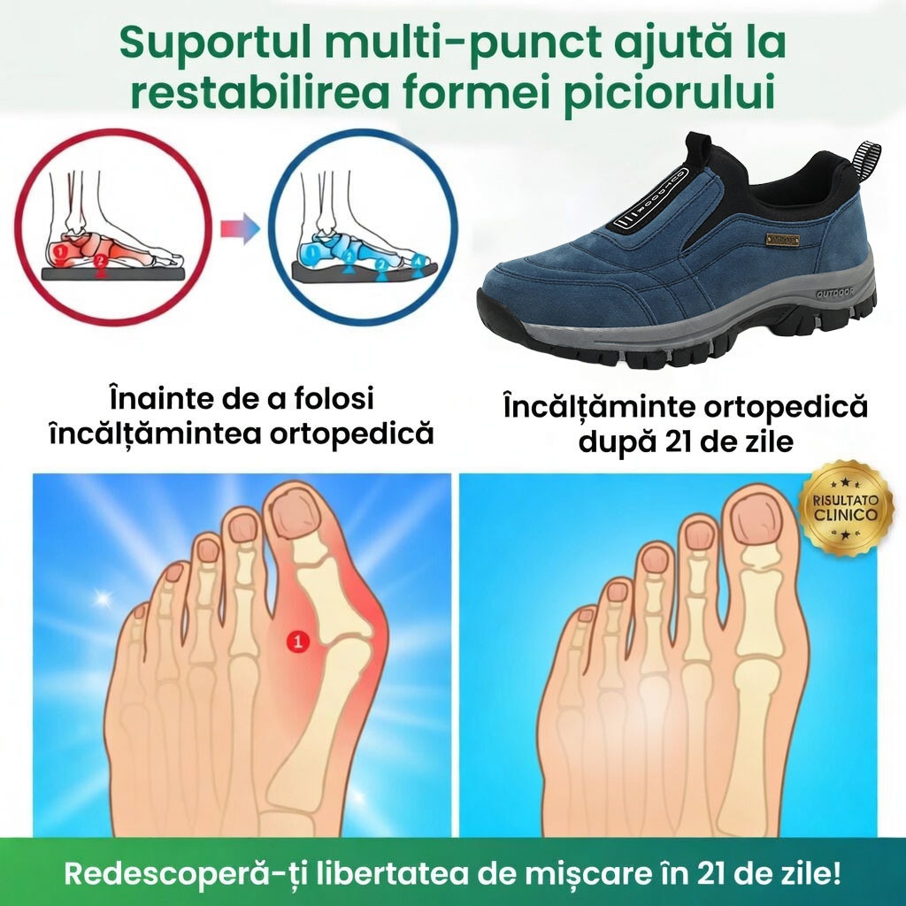 🎁Ultima zi pentru a te bucura de o reducere de 50%! Nu rata ocazia! ⏰ Ameliorează durerile de picioare și fasciita - Încălțăminte ortopedică impermeabilă și antiderapantă.
