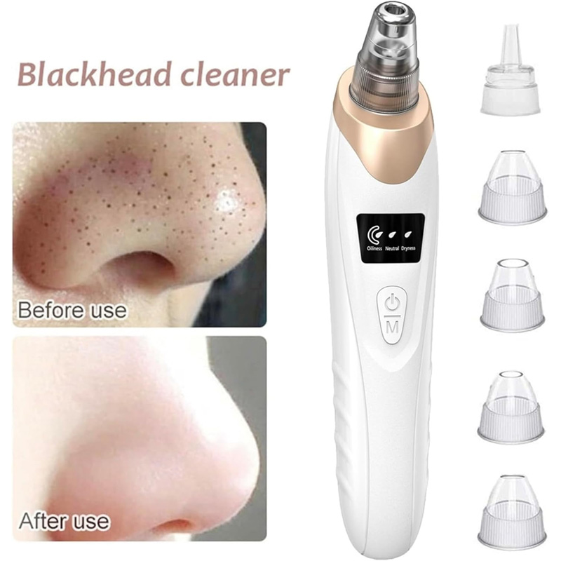 Electric blackhead remover