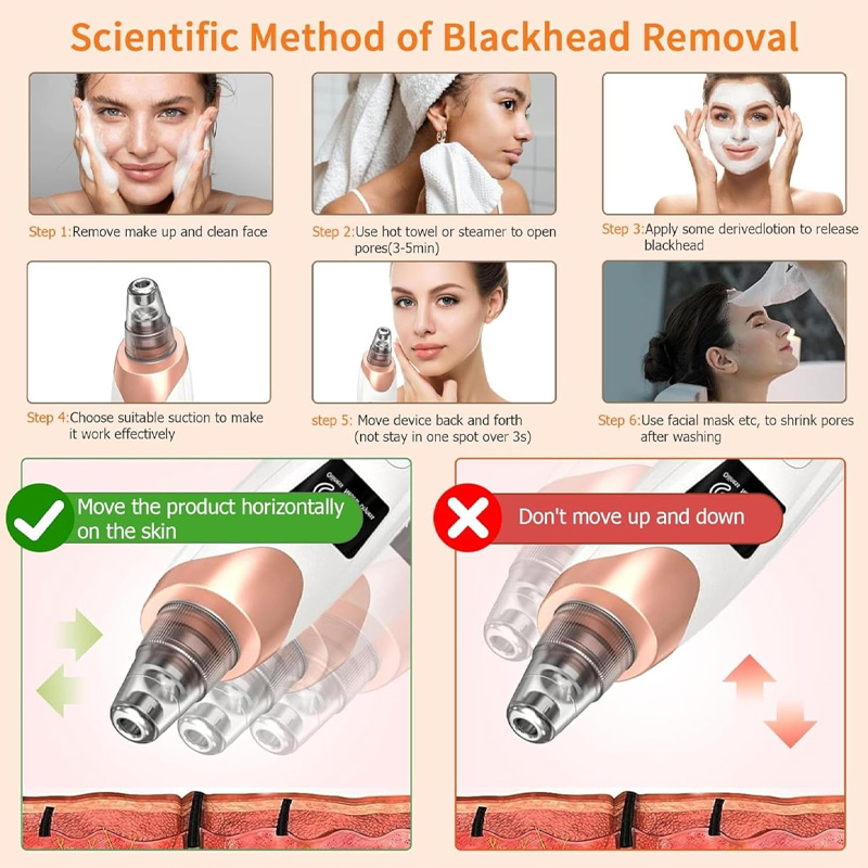 Electric blackhead remover