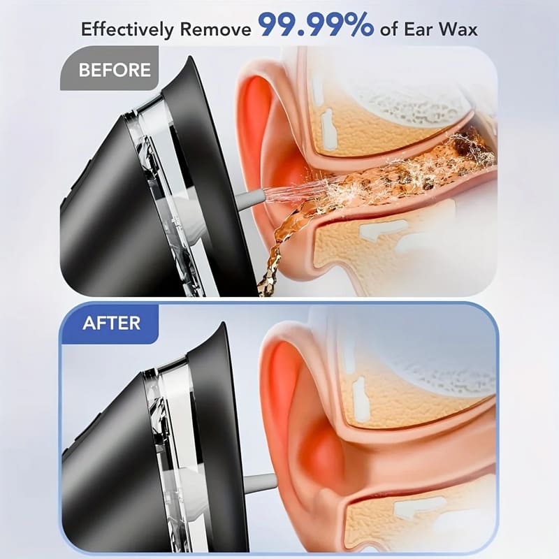 Home painless earwax remover