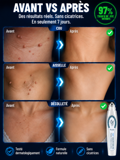 Tomber le stylo de réparation de la peau en un rouleau🎁 OFFRE FOLLE : Profitez de notre promo 1 ACHETÉ = 1 OFFERT