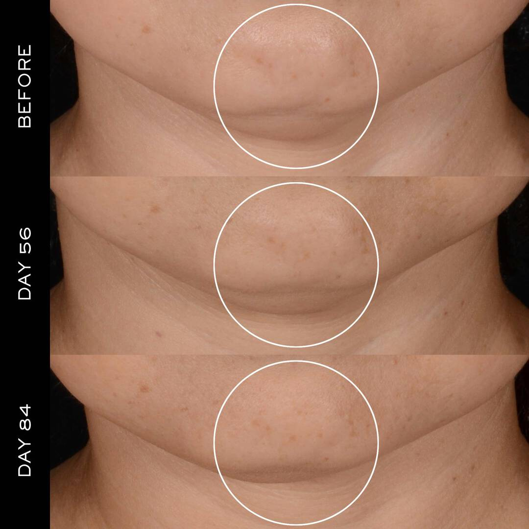 Lancôme RÉNERGIE H.P.N. 300-PEPTIDE CREAM