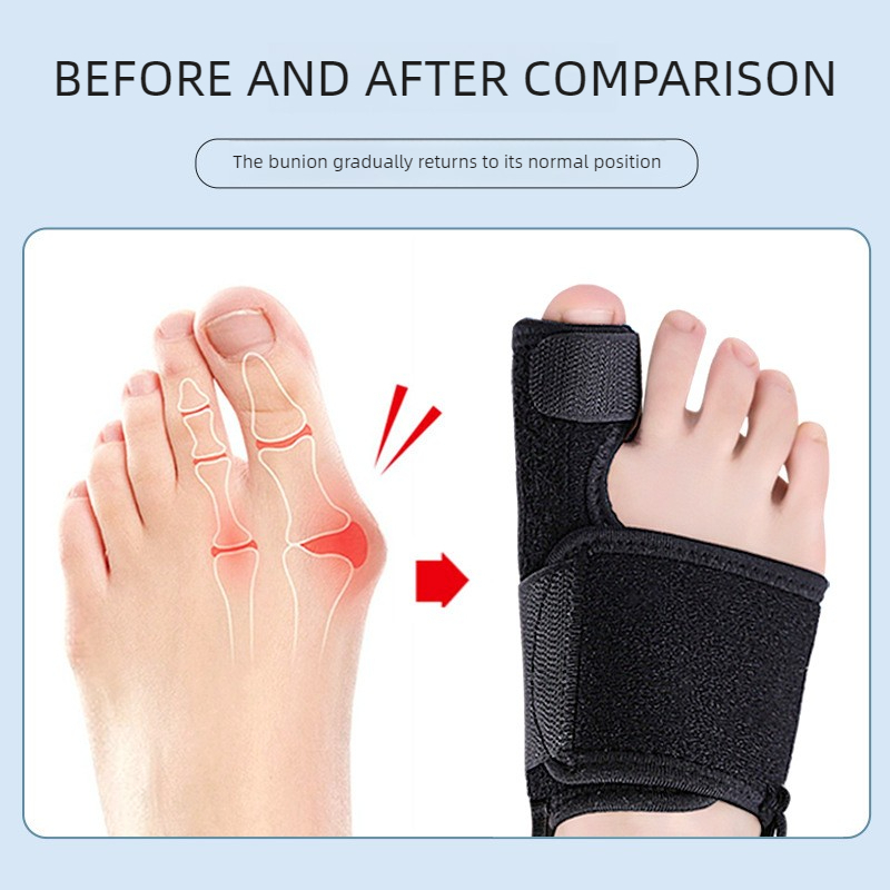 Soft Bunion Corrector