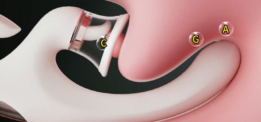 Stage 1