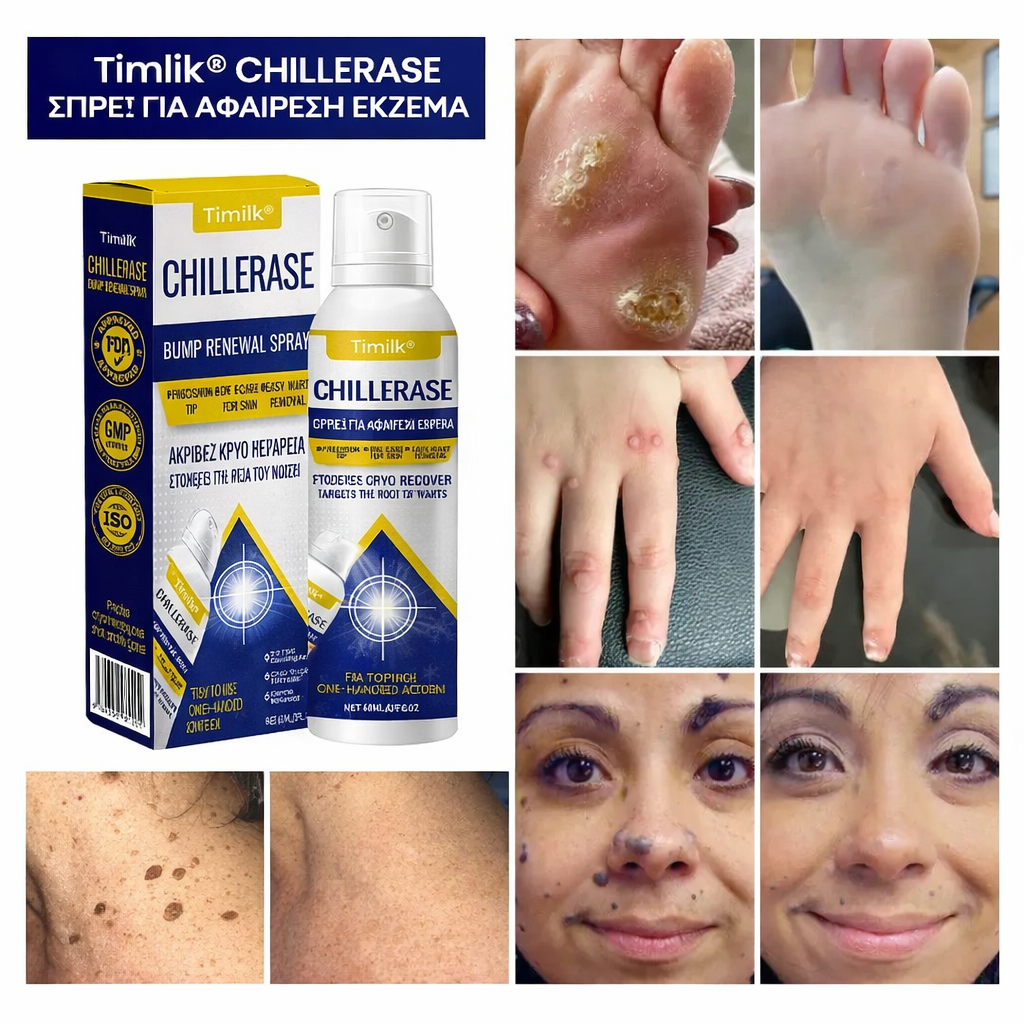 Timilk® ChillErase | Φυσική Αφαίρεση Φυματίων & Σπίλων-Hellasbeauty