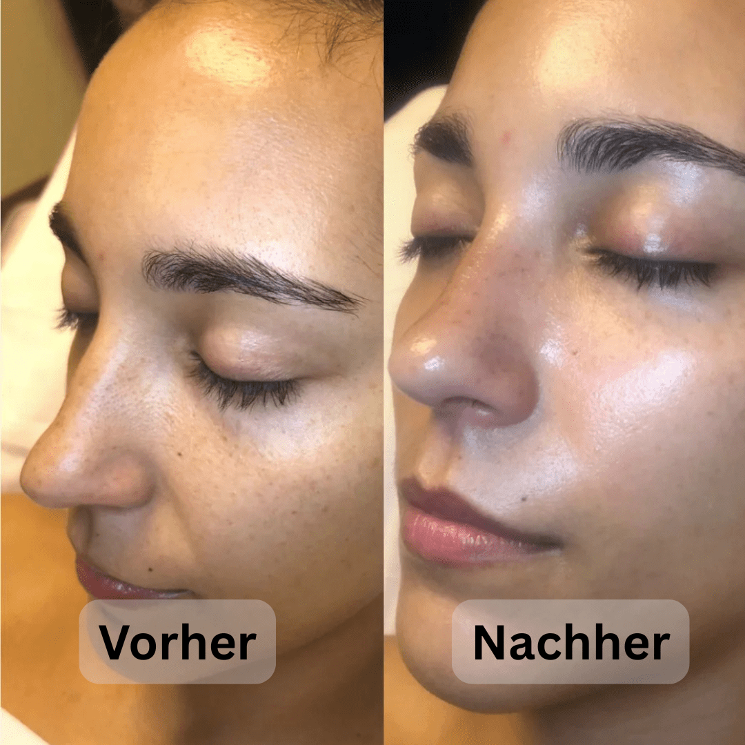 Reis Peeling-Hellasbeauty