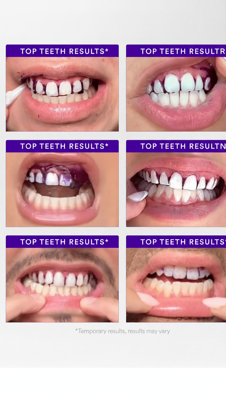 V34 Λευκαντικές Λωρίδες-Hellasbeauty