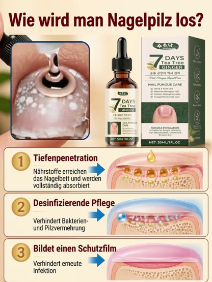 【Nagelpflegelösung 】Dringt tief in die Nägel ein und bekämpft Nagelpilz an der Wurzel.