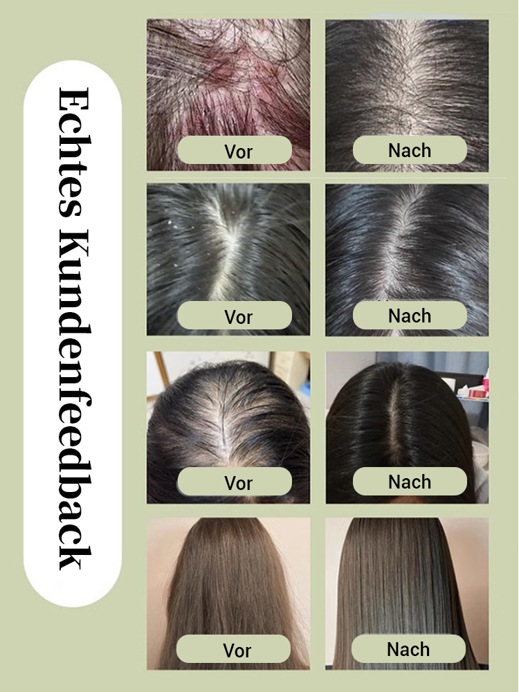 【Rosmarin-Keratin-Volumenshampoo】✨Sichtbare Ergebnisse in 2 Wochen bei starkem Haarausfall✨Dichtes Haar wie in jungen Jahren – durch dauerhafte Anwendungp✨