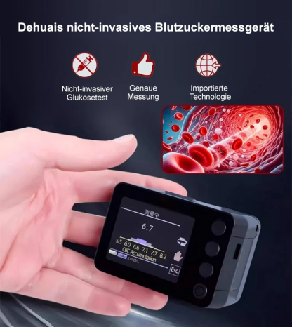【Fingerclip-Pulsoximeter】✌️Kein Stechen in den Finger nötig👍Genauigkeit 99%