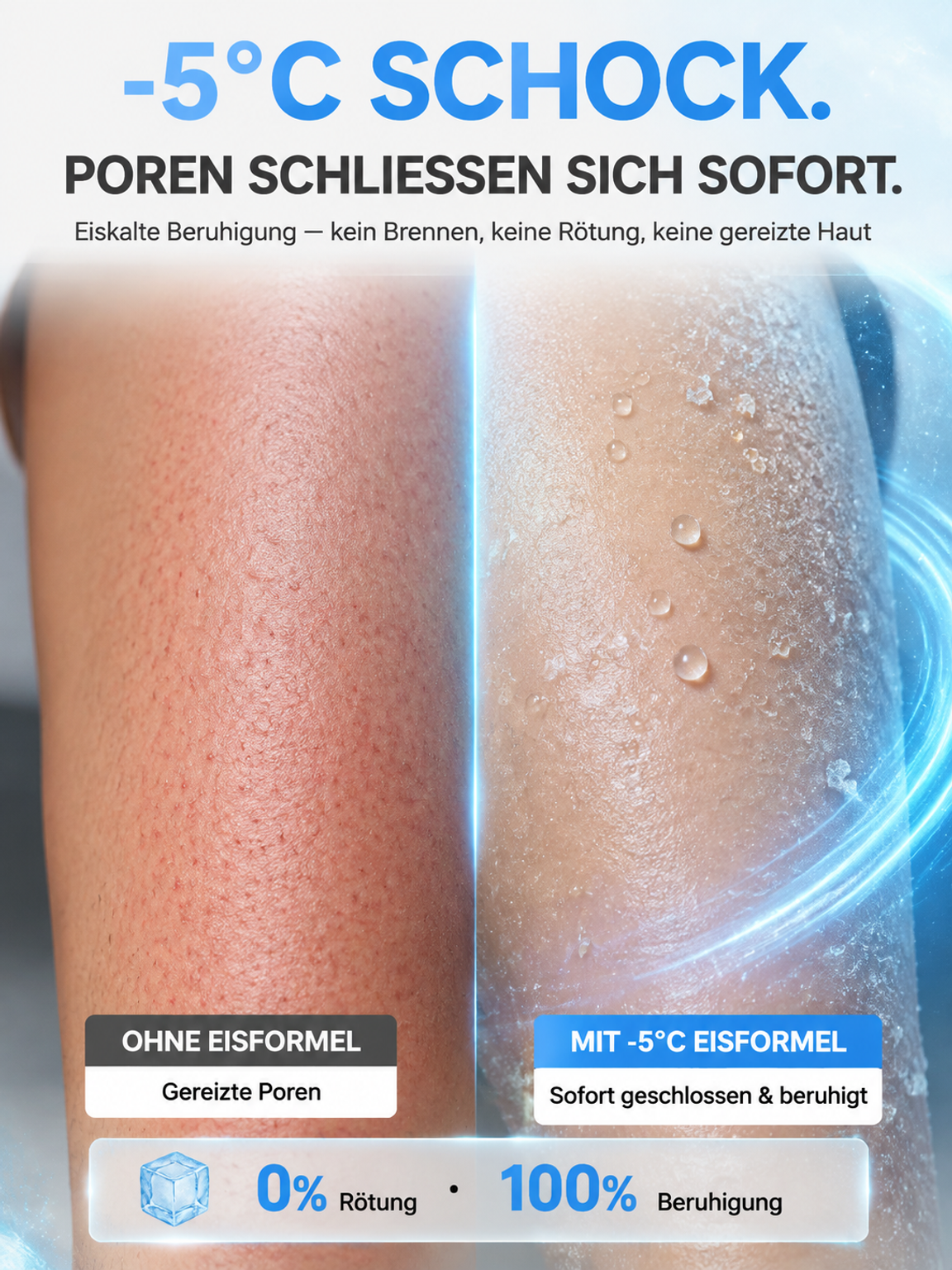 ❄️ -5°C Eiskalt-Effekt: Schluss mit Rasurextremismus & Wachsschmerzen! ✨ Seidig glatte Haut in nur 3 Minuten – Ganz ohne schwarze Stoppeln.